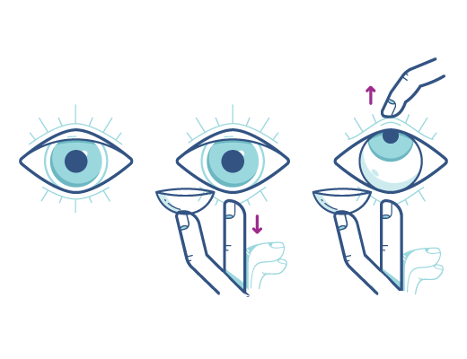 Prevent blinking Prevent blinking